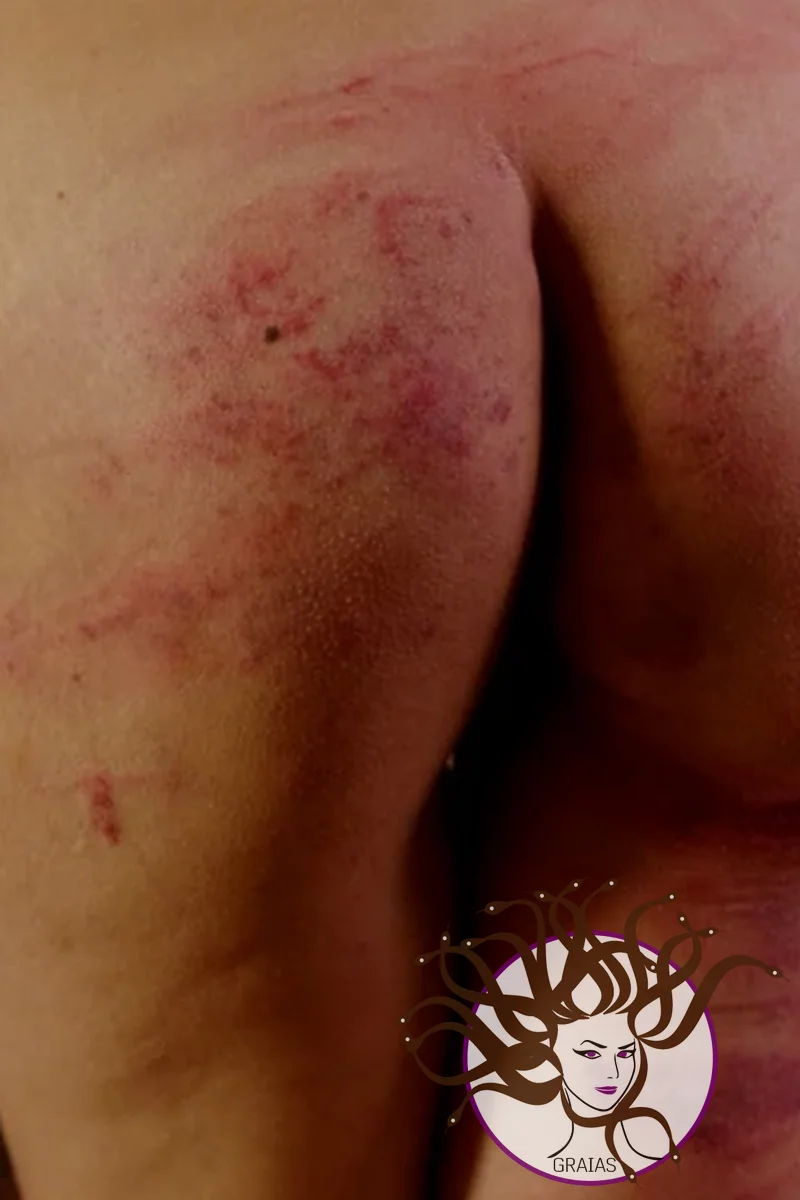 Difference of Pain Reaction - Part 6 - Screenshot 1 of 4 - Crops