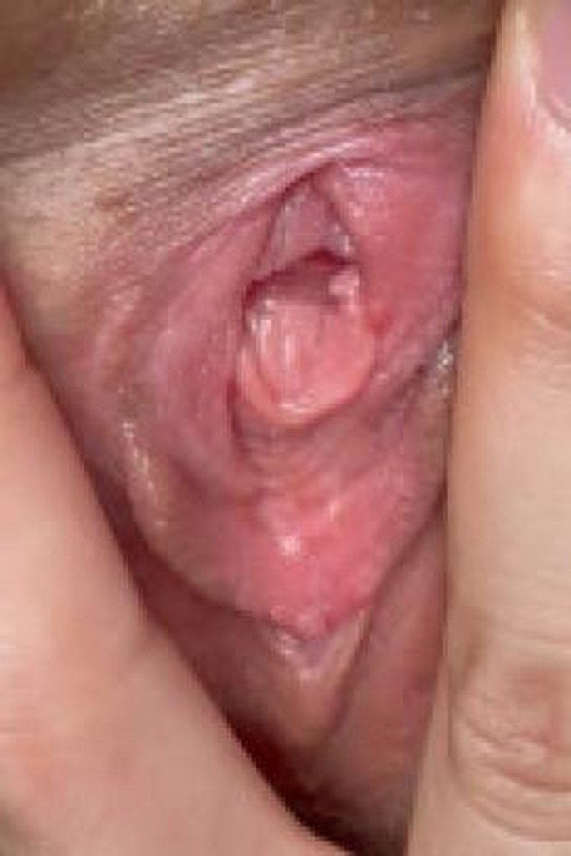 Queefing - Screenshot 1 of 4 - Close Up