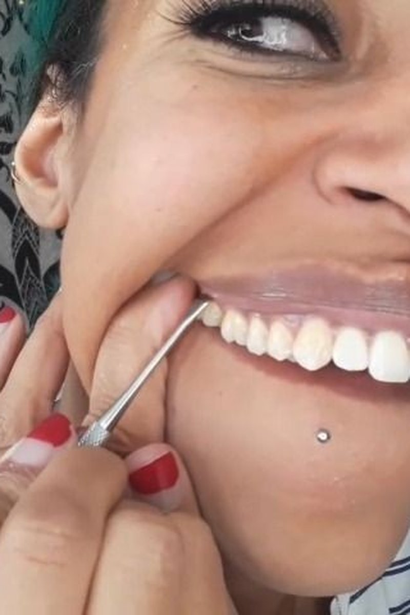 Teeth Scraping - Screenshot 1 of 4 - Fetish
