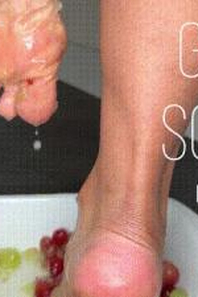 Grape Squash - Screenshot 1 of 4 - Food