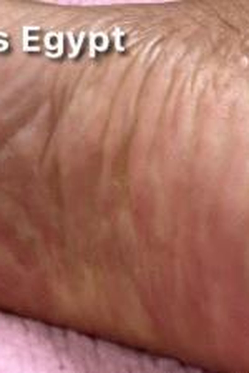 Foot Freak - Screenshot 1 of 4 - Black
