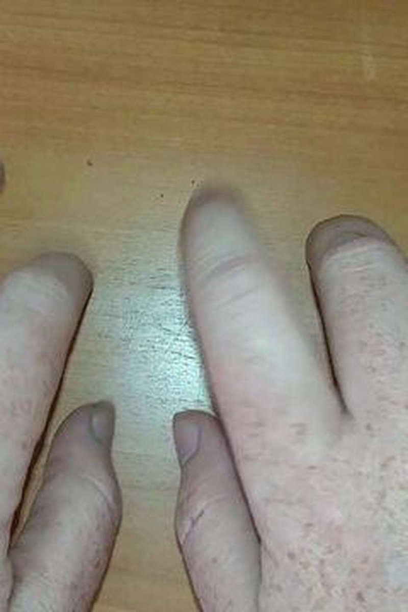 Fingernail Tapping - Screenshot 1 of 4 - Fetish