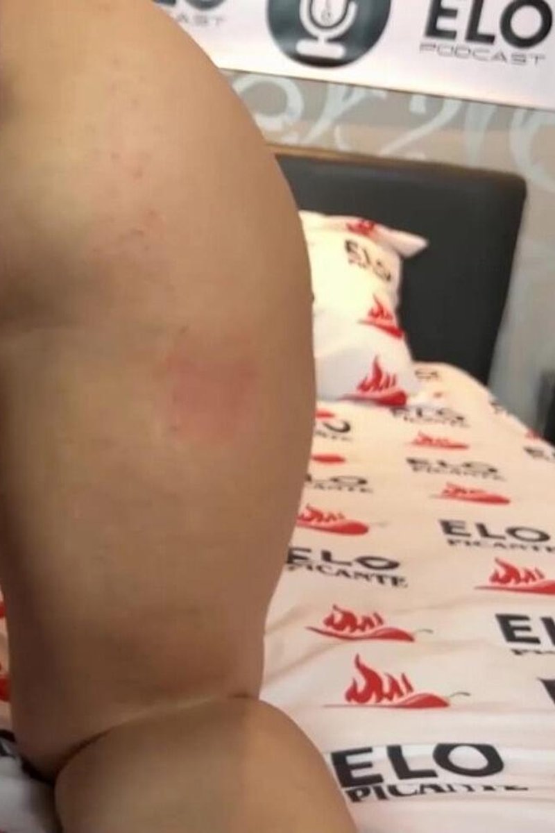Michu Wars Folla Con Elo Podcast - Screenshot 1 of 4 - Babes