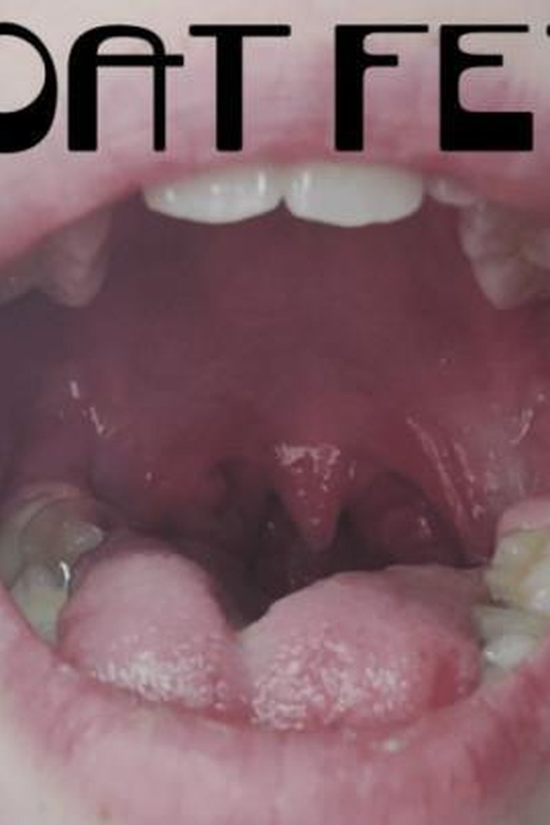 Throat Fence Fetish - Screenshot 1 of 4 - Mouth Fetish