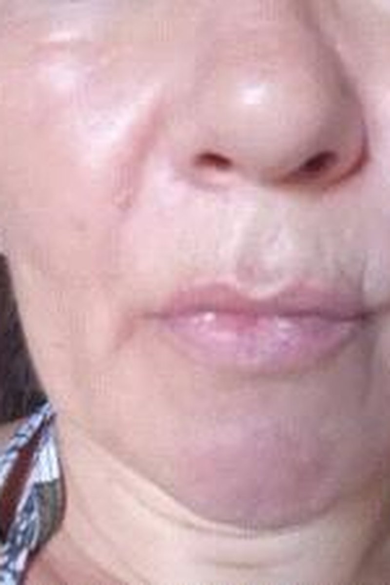 Nose - Screenshot 1 of 4 - Nose Fetish