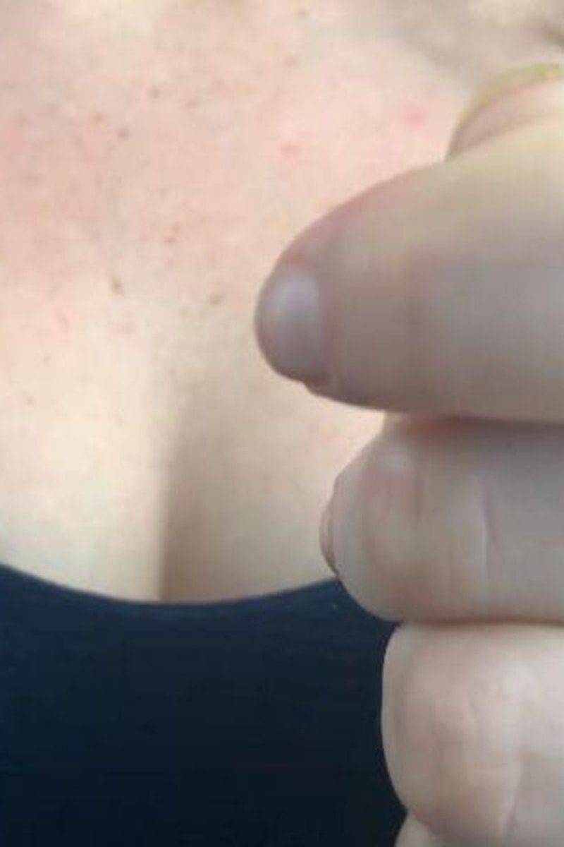 My Scars - Screenshot 1 of 4 - Fair Skin