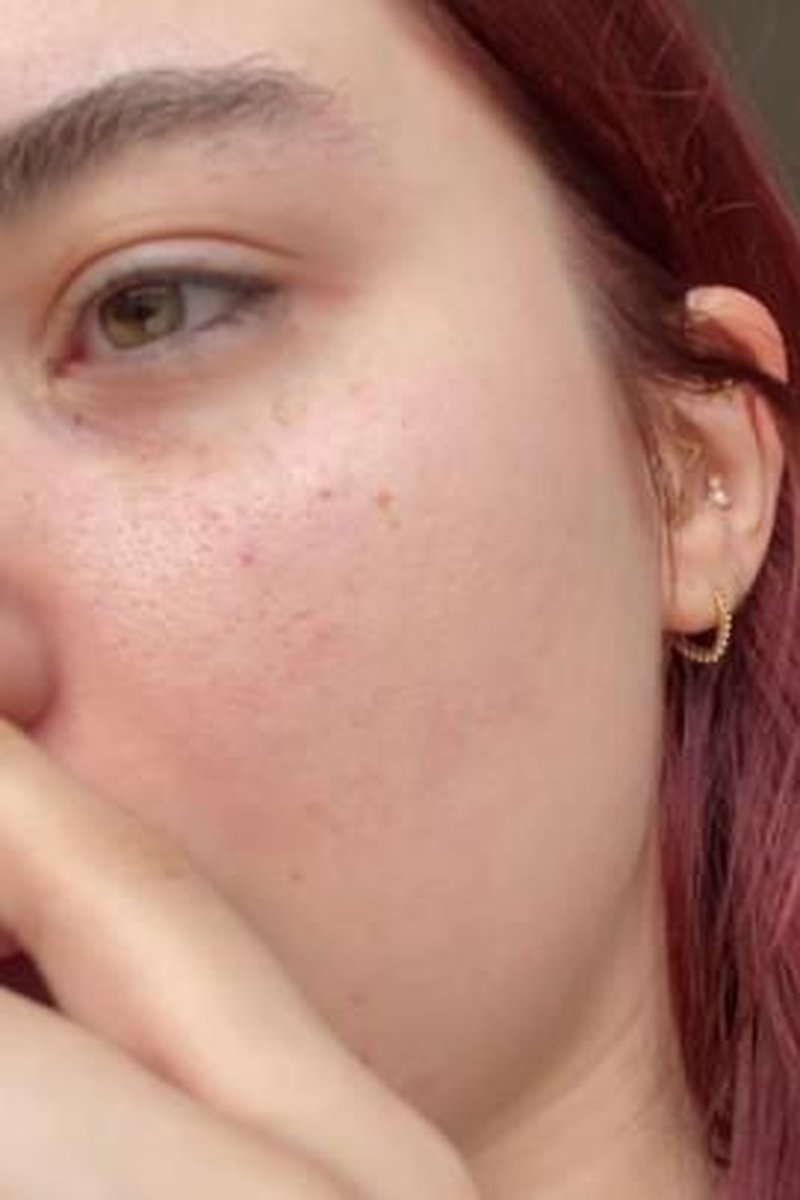 Nose Picking Compilation - Screenshot 1 of 4 - Big Nose