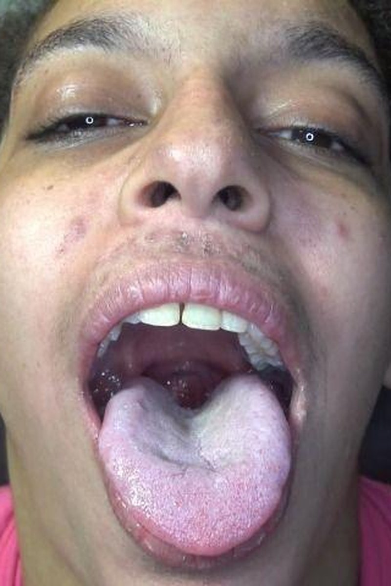 Ugly Girl Mouth Explo, Scared - Screenshot 1 of 4 - Mouth Fetish