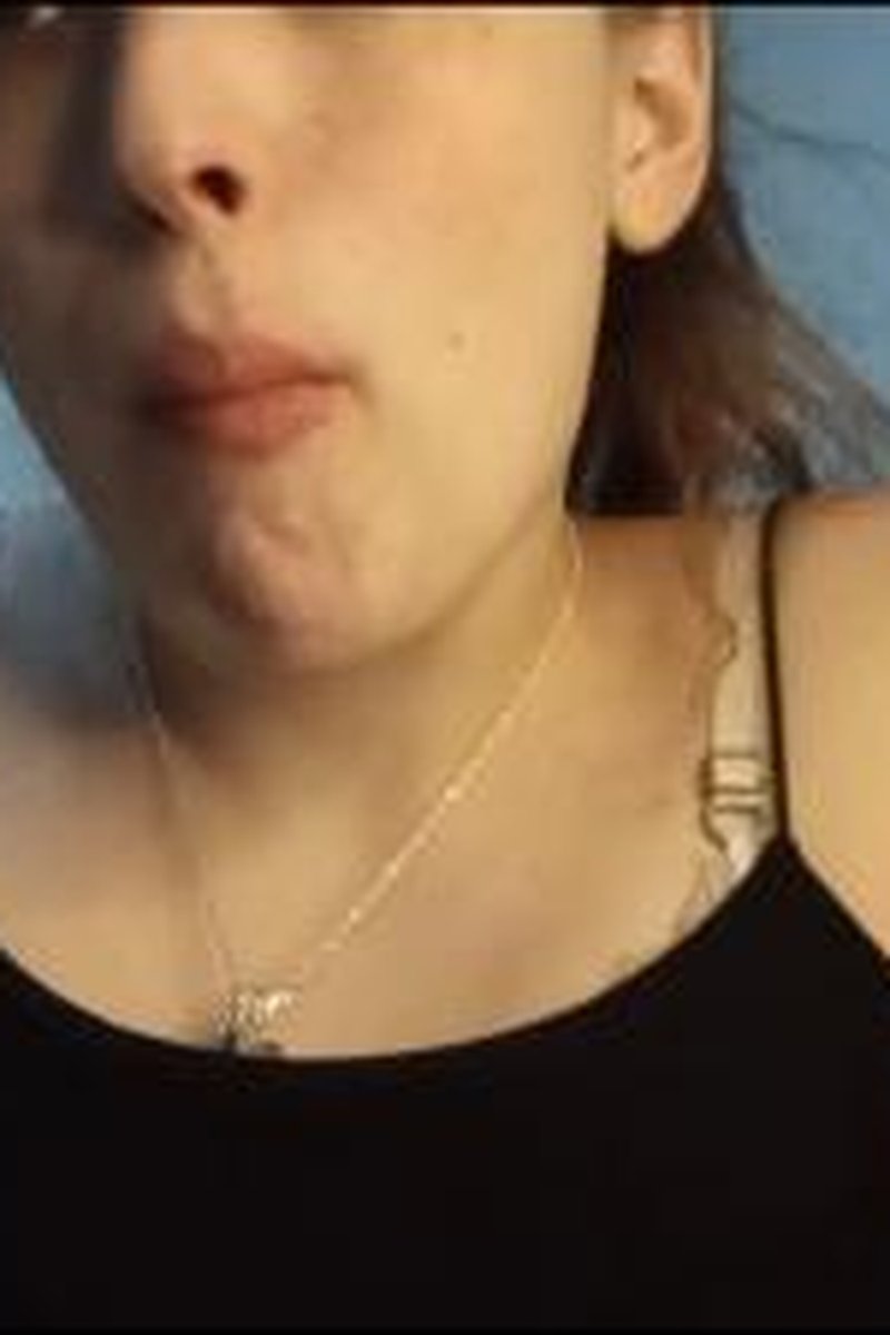 Bubblegum,Teeth And Tongue - Screenshot 1 of 4 - Bubble Gum Tease