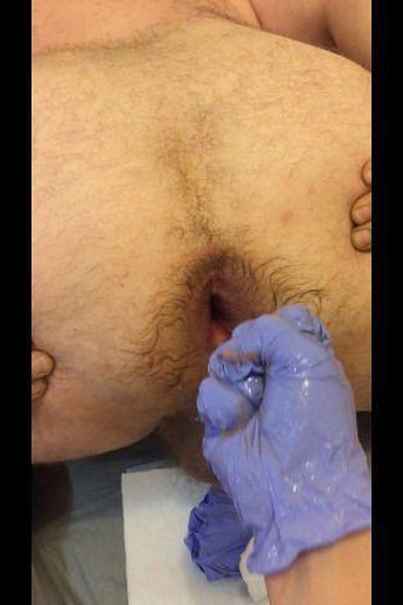 Fisting - Screenshot 1 of 4 - Absolute Strength