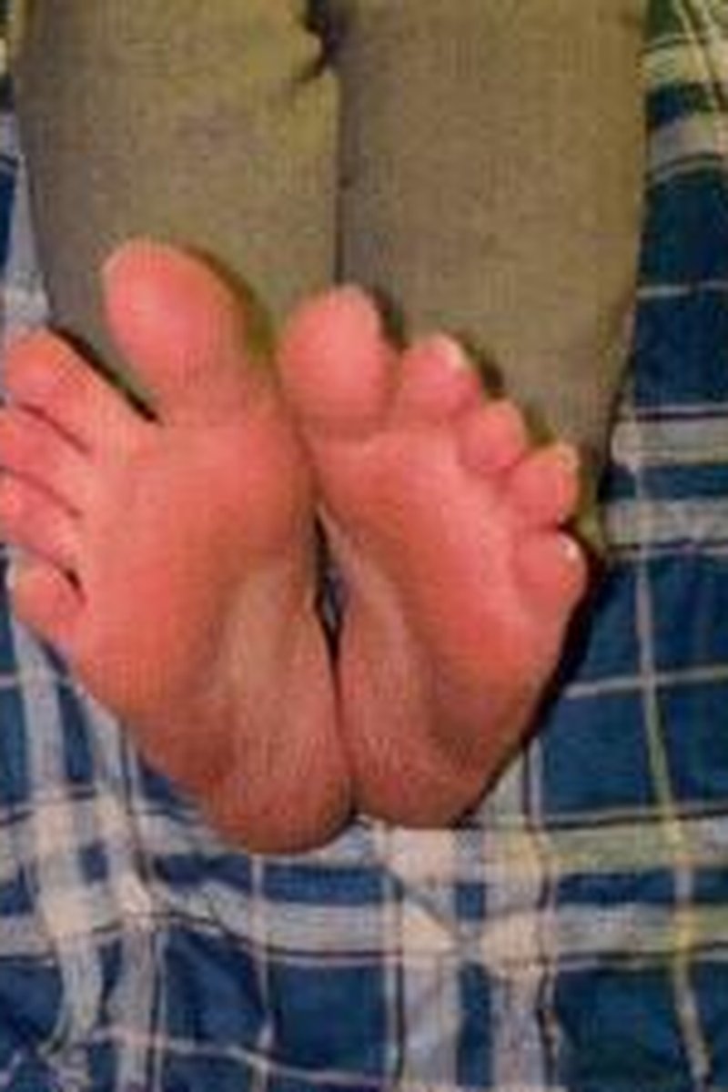 Dirty Feet With White Toes A Delicious Combination! - Screenshot 1 of 4 - Foot Fetish