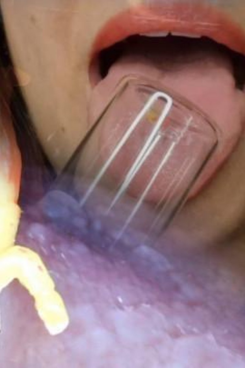 The Trap Jar - Screenshot 1 of 4 - Endoscopethroat