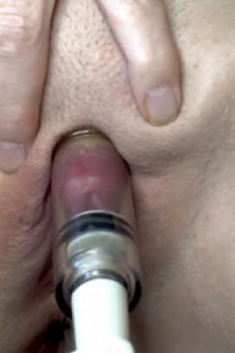 Clit Suctioning - Screenshot 1 of 4 - Big Clit
