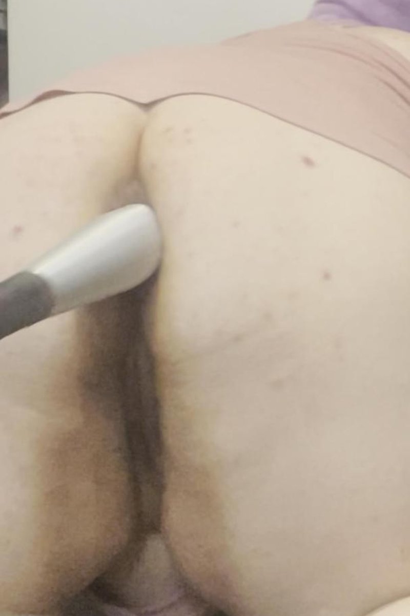 Baseball Bat Anal Insertion - Screenshot 1 of 4 - Anal Masturbation