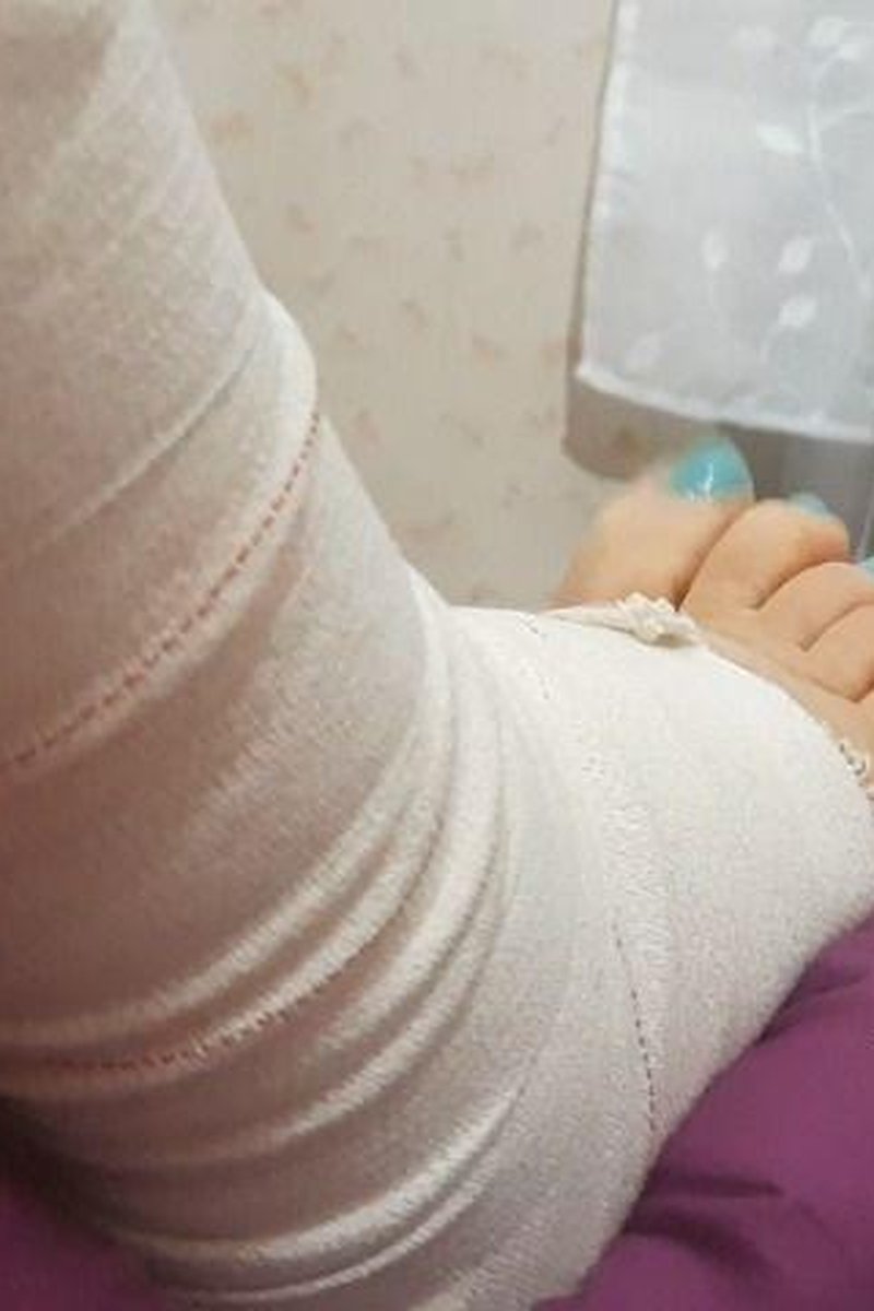 Sprained Ankle - Screenshot 1 of 4 - Ankle Sprain