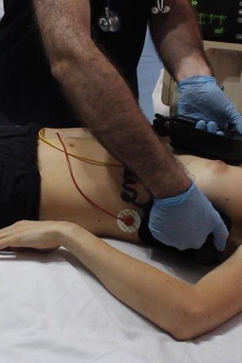Cardioversion In Er - Screenshot 1 of 4 - Cardio