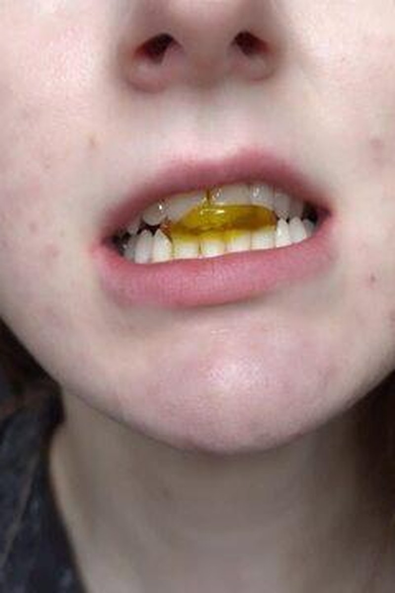 Chewed Gummies - Screenshot 1 of 4 - Amateur