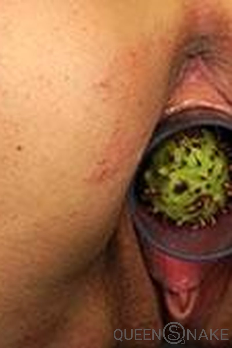 Catapult - Screenshot 1 of 4 - Conkers