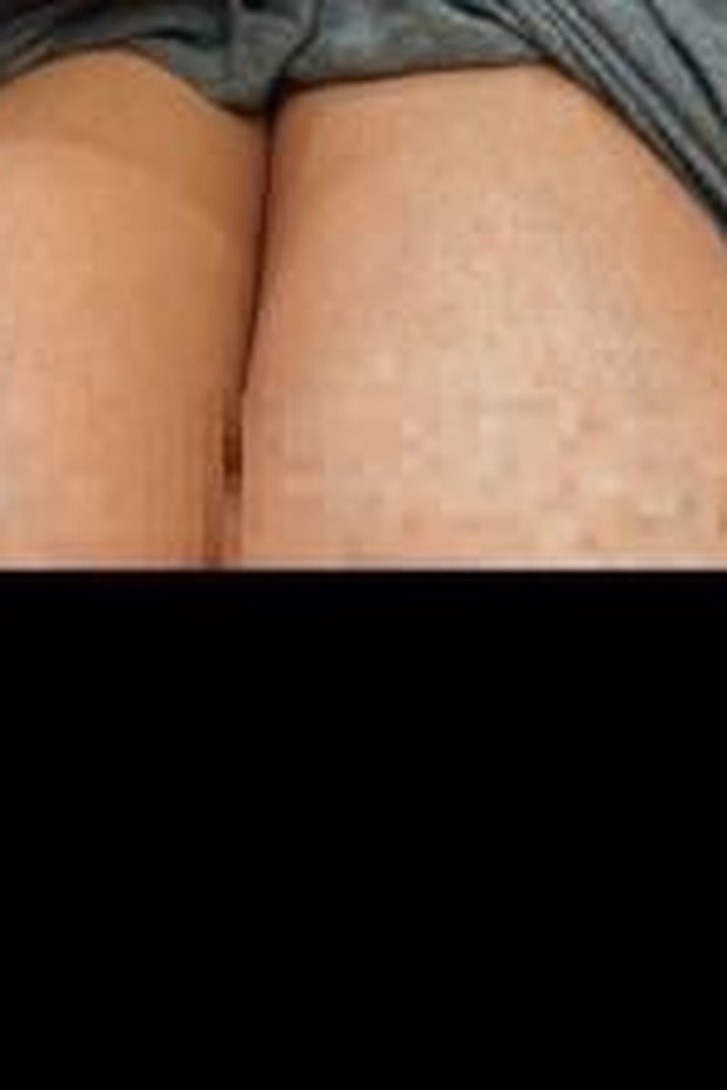 Huge Areolas! - Screenshot 1 of 4 - BBW