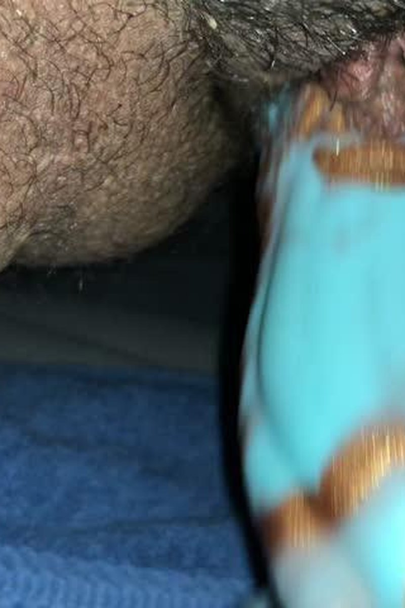 Gaping -Transman - Screenshot 1 of 4 - Masturbation