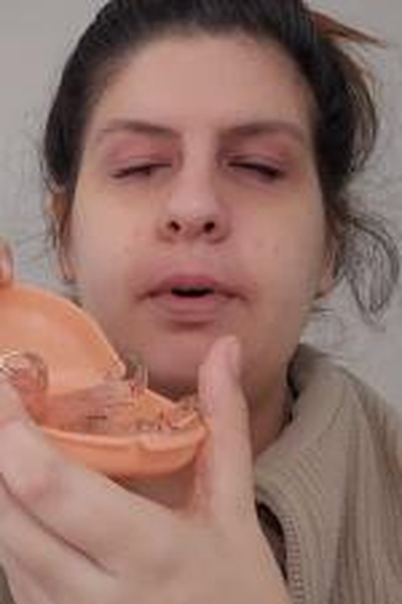 Retainers Close Up - Screenshot 1 of 4 - Braces Fetish