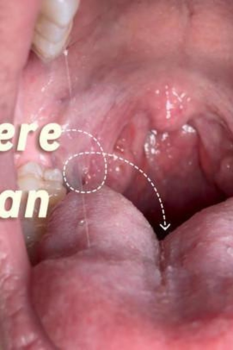 Enter Here Tiny Man - Screenshot 1 of 4 - Fetish