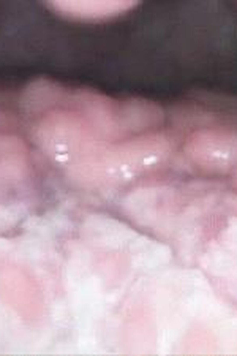 Grape Swallowing - Screenshot 1 of 4 - Chewing