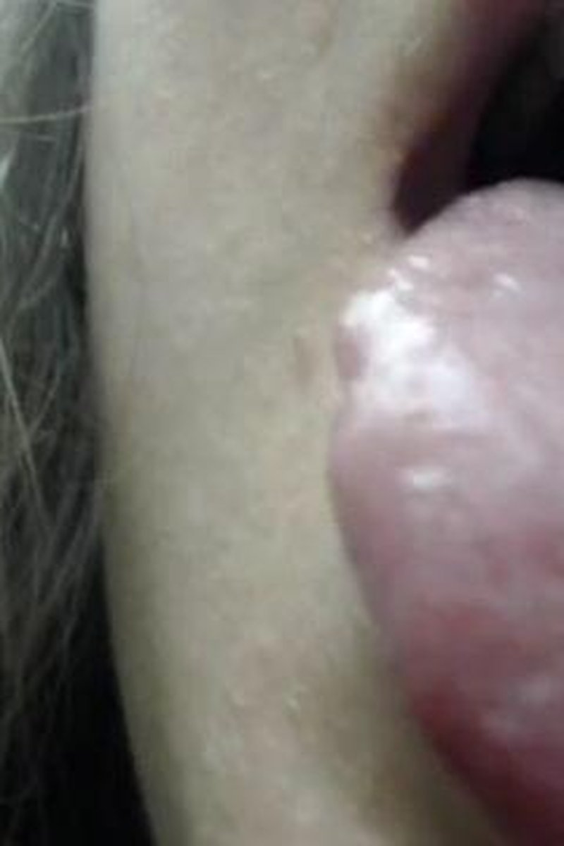 Serephs Tastebuds - Screenshot 1 of 4 - Freckles