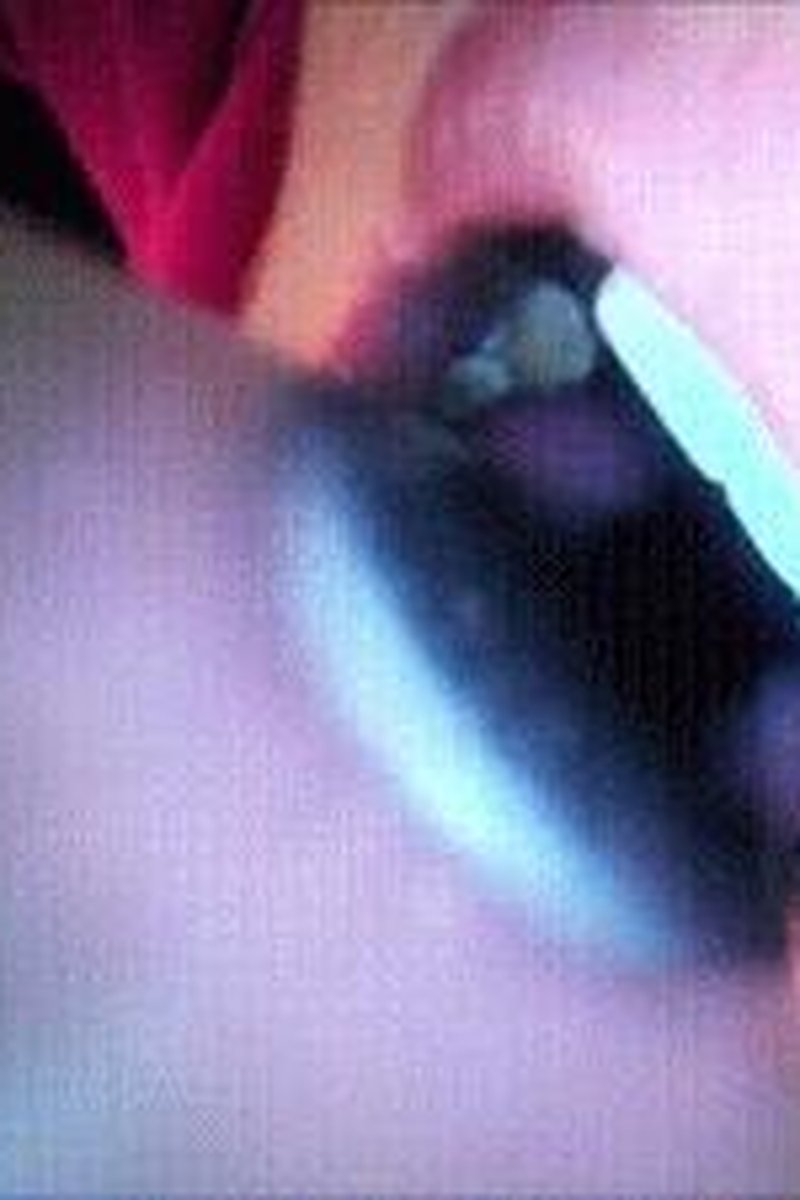 Swallow **** Endoscope - Screenshot 1 of 4 - Fantasy