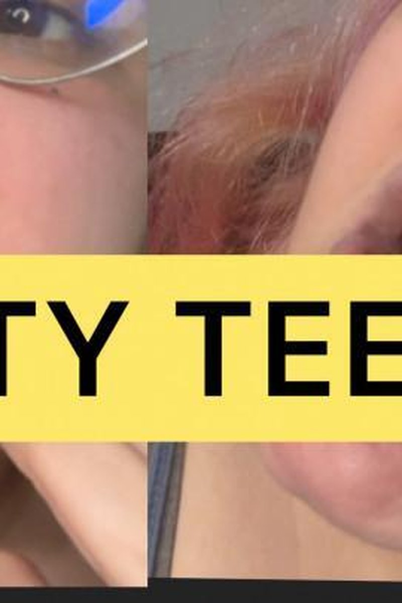 Dirty Teeth - Screenshot 1 of 4 - Finger Brushing