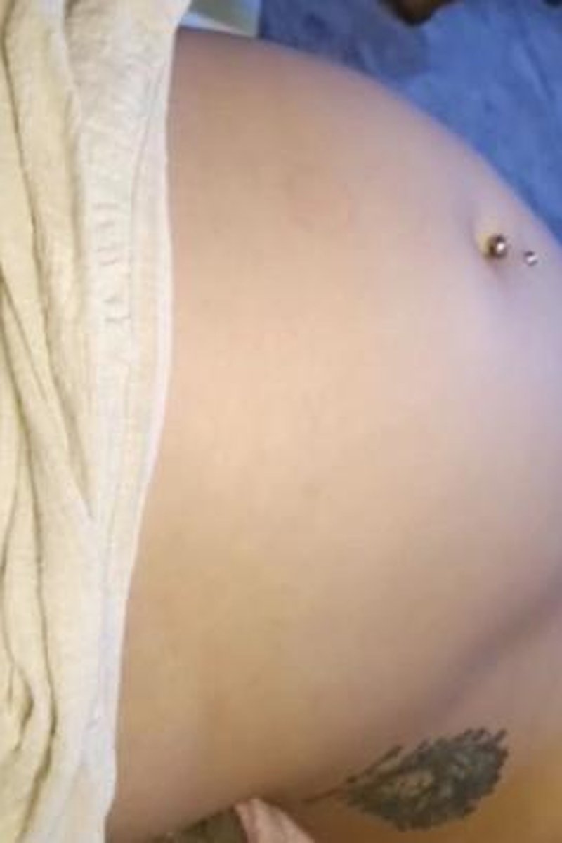 Belly Expansion - Screenshot 1 of 4 - Medical Fetish