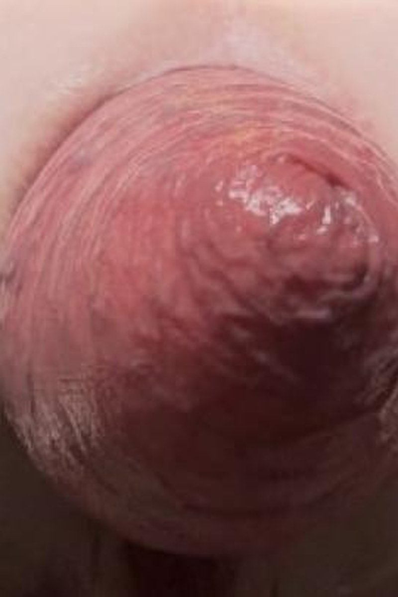 Major Prolapse - Screenshot 1 of 4 - Anal