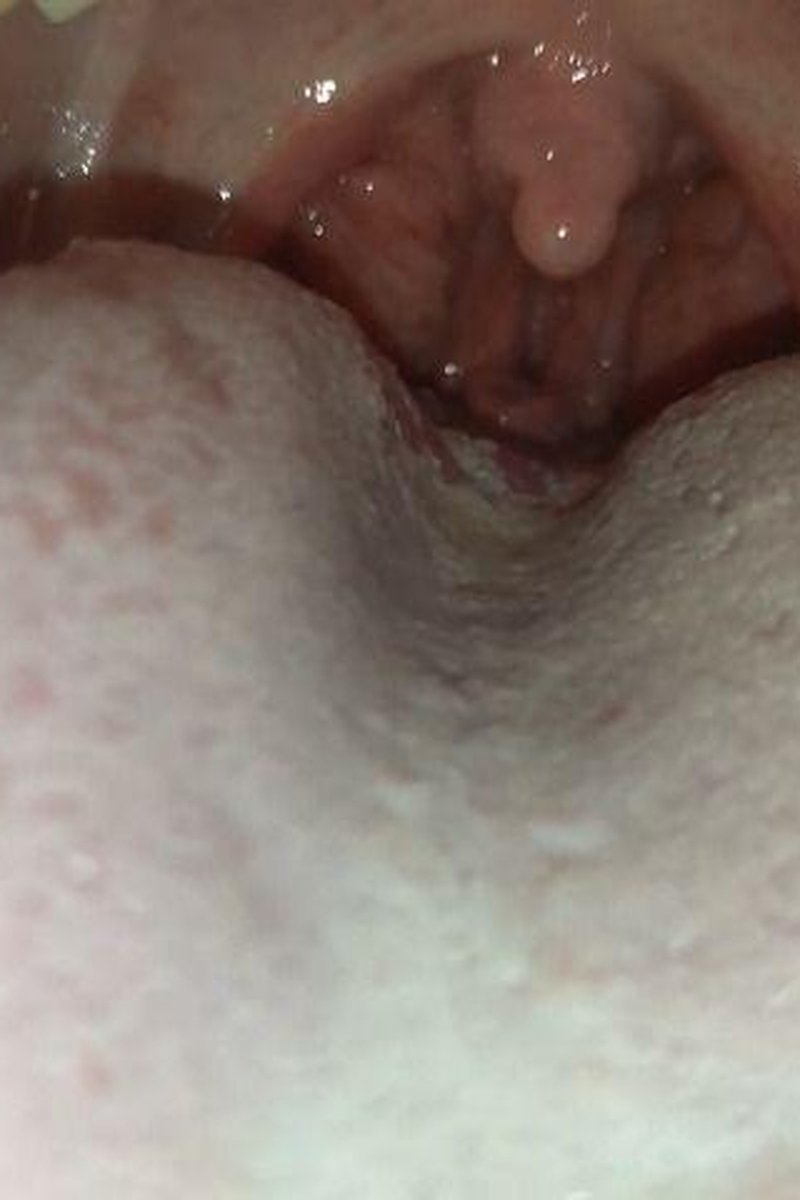 Constricting Throat - Screenshot 1 of 4 - Mouth Fetish