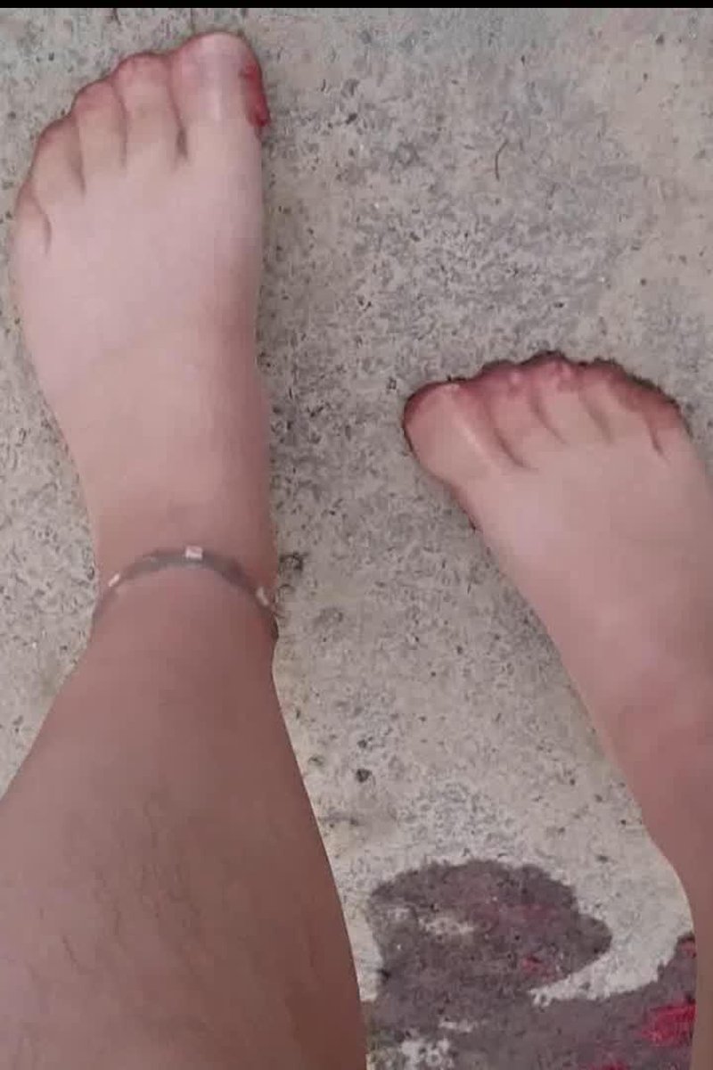 The Second Strawberry Trample - Screenshot 1 of 4 - Foot Fetish