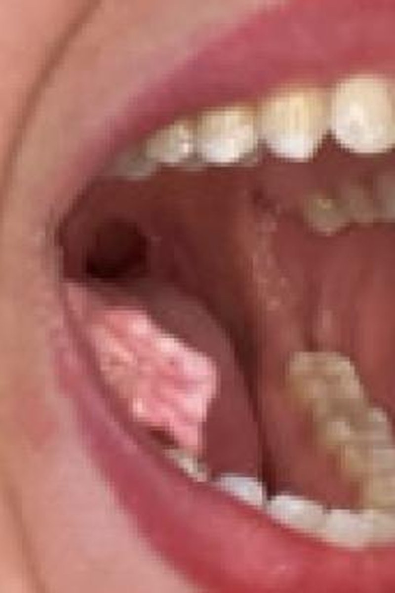 Chewing Sideways - Screenshot 1 of 4 - Bubble Gum