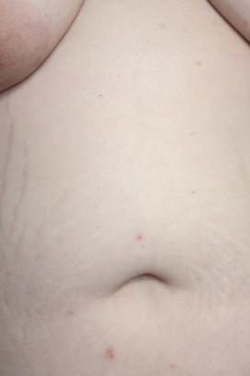 Stretch Mark Showoff - Screenshot 1 of 4 - BBW