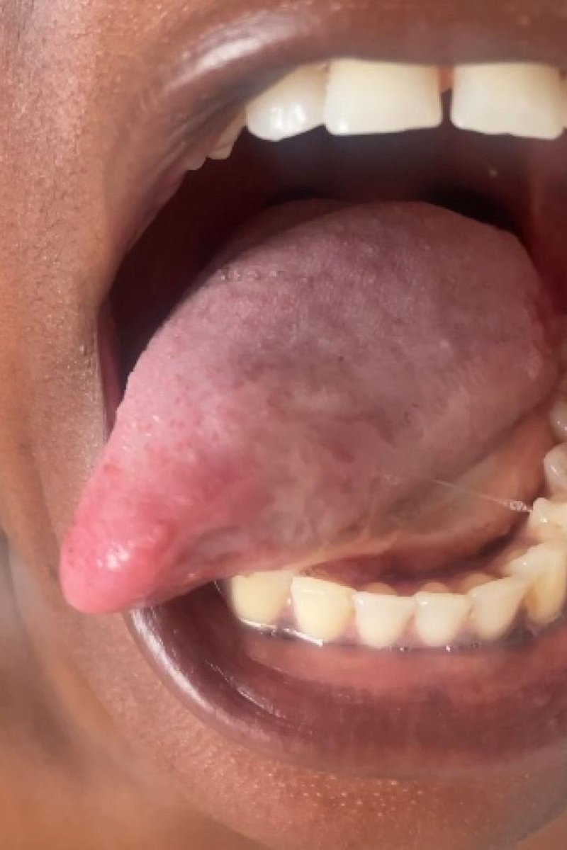 Ebony Mouth, Teeth, Tongue Tour - Screenshot 1 of 4 - Black