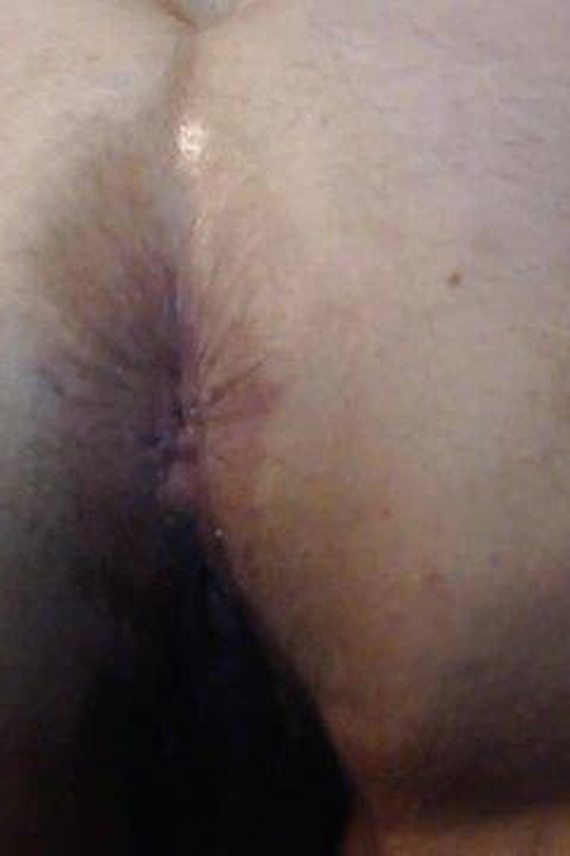 Ass Spreading - Screenshot 1 of 4 - Amateur