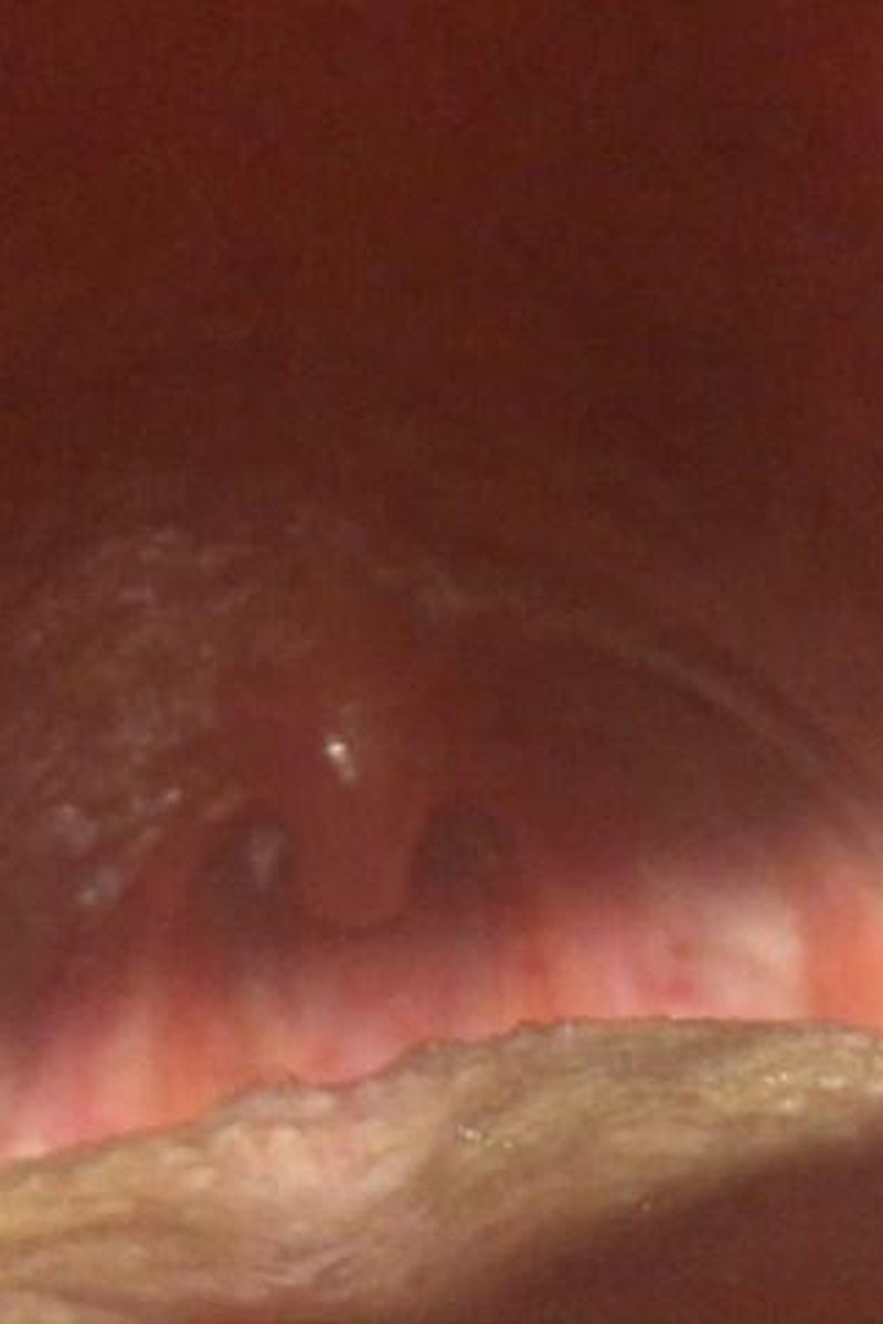 Uvula Dancing - Screenshot 1 of 4 - Mouth Fetish