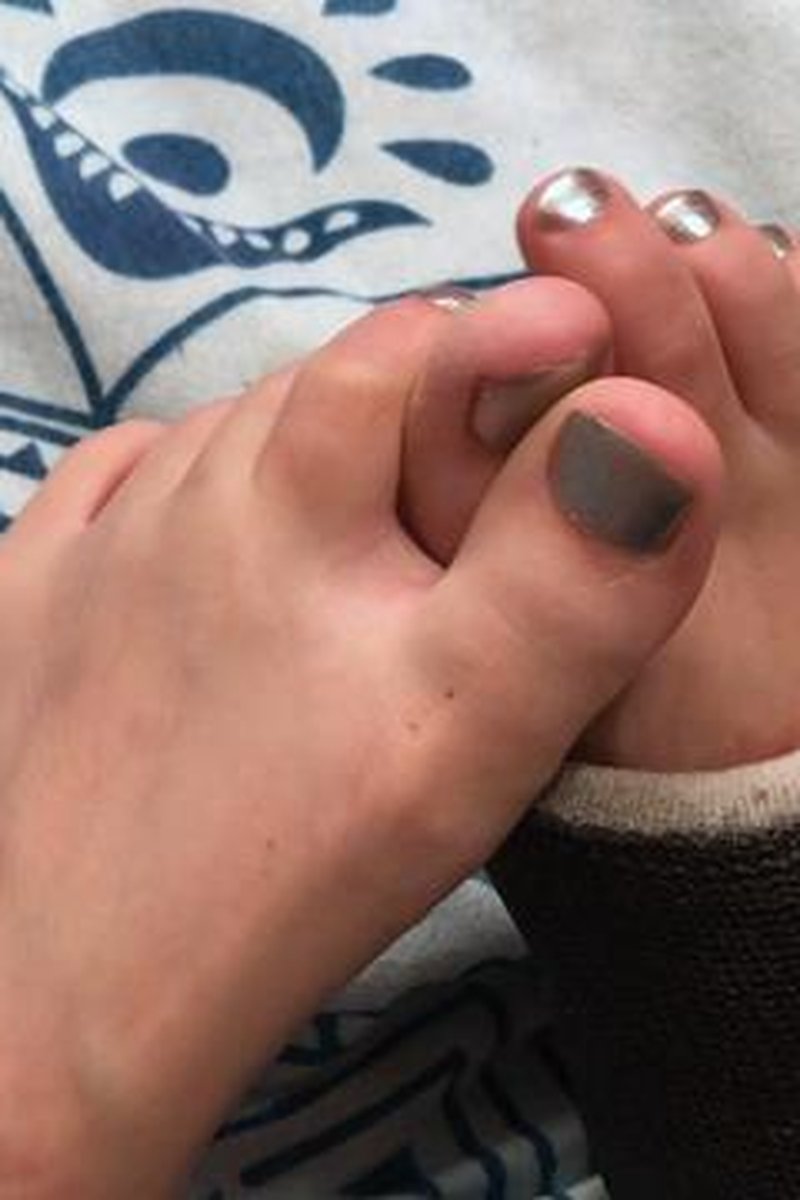 Casted Foot - Screenshot 1 of 4 - Cast