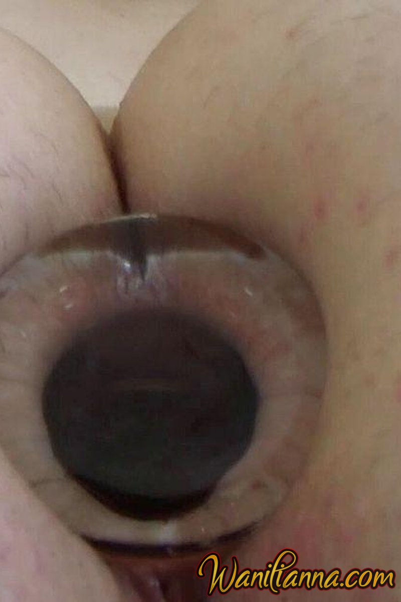 Anal Plug Experience - Screenshot 1 of 4 - Amateur