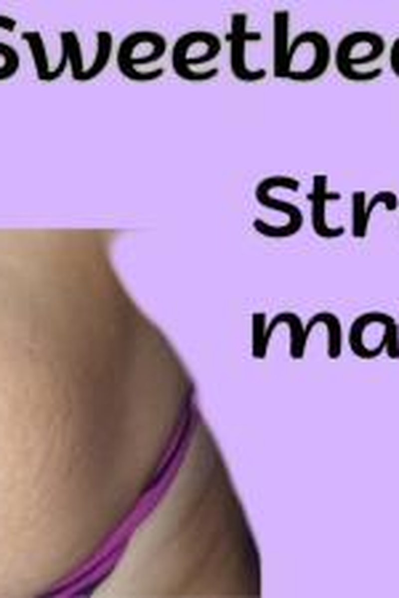 Strech Marks - Screenshot 1 of 4 - BBW