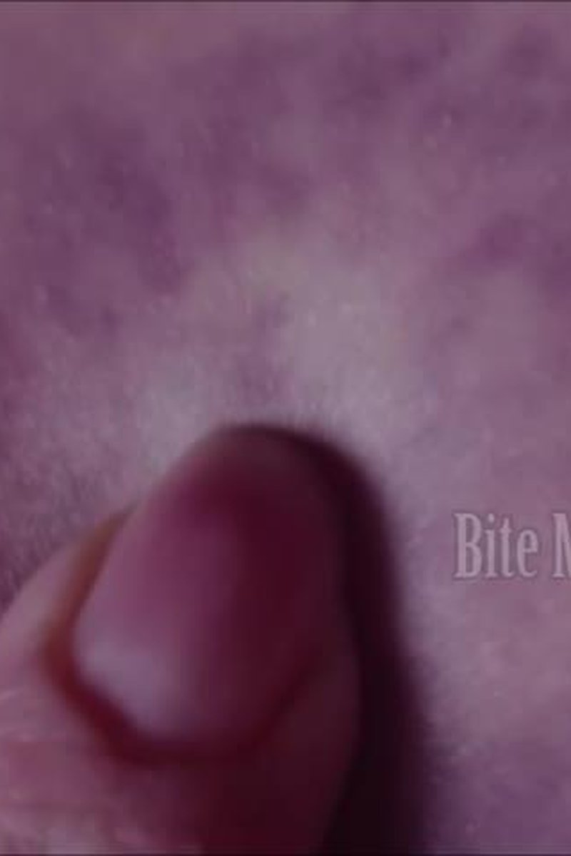 Bite Mark Bruises - Screenshot 1 of 4 - Biting