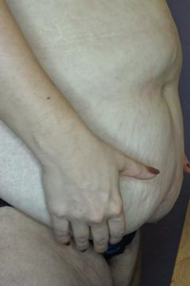 Belly Dropping - Screenshot 1 of 4 - BBW