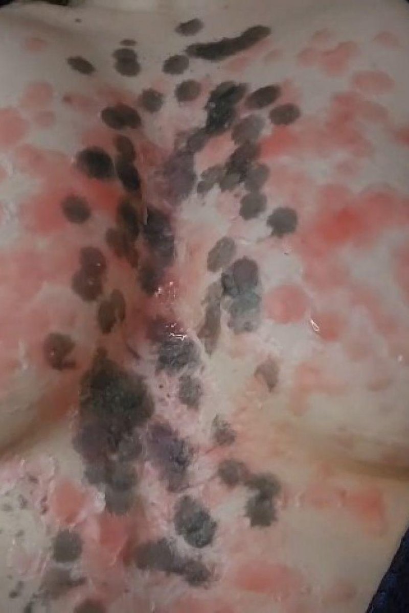 Wax Play Drip And Real Pain Reaction - Screenshot 1 of 4 - BDSM