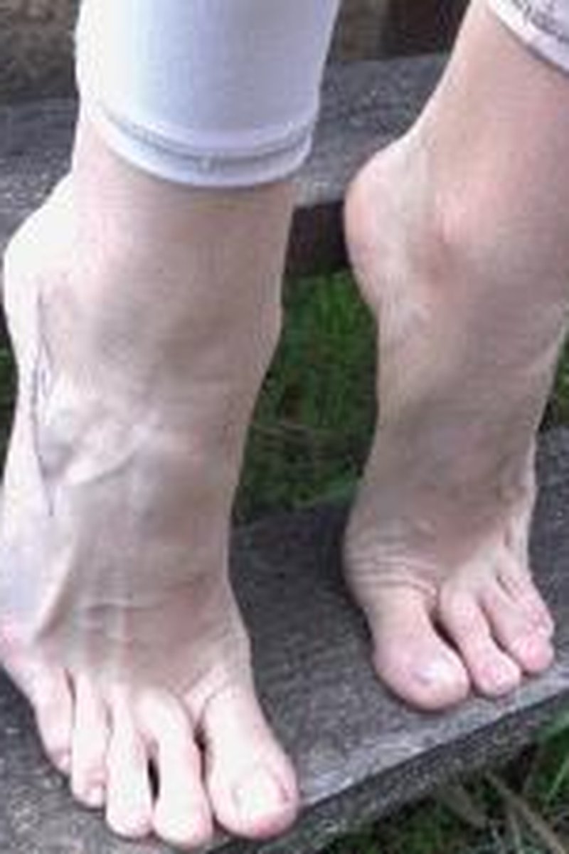 Rea Finally Natural Foot Fetish - Screenshot 1 of 4 - Foot Fetish