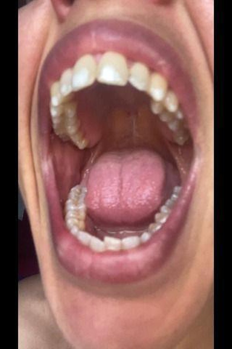 Teeth Tour - Screenshot 1 of 4 - Mouth Fetish