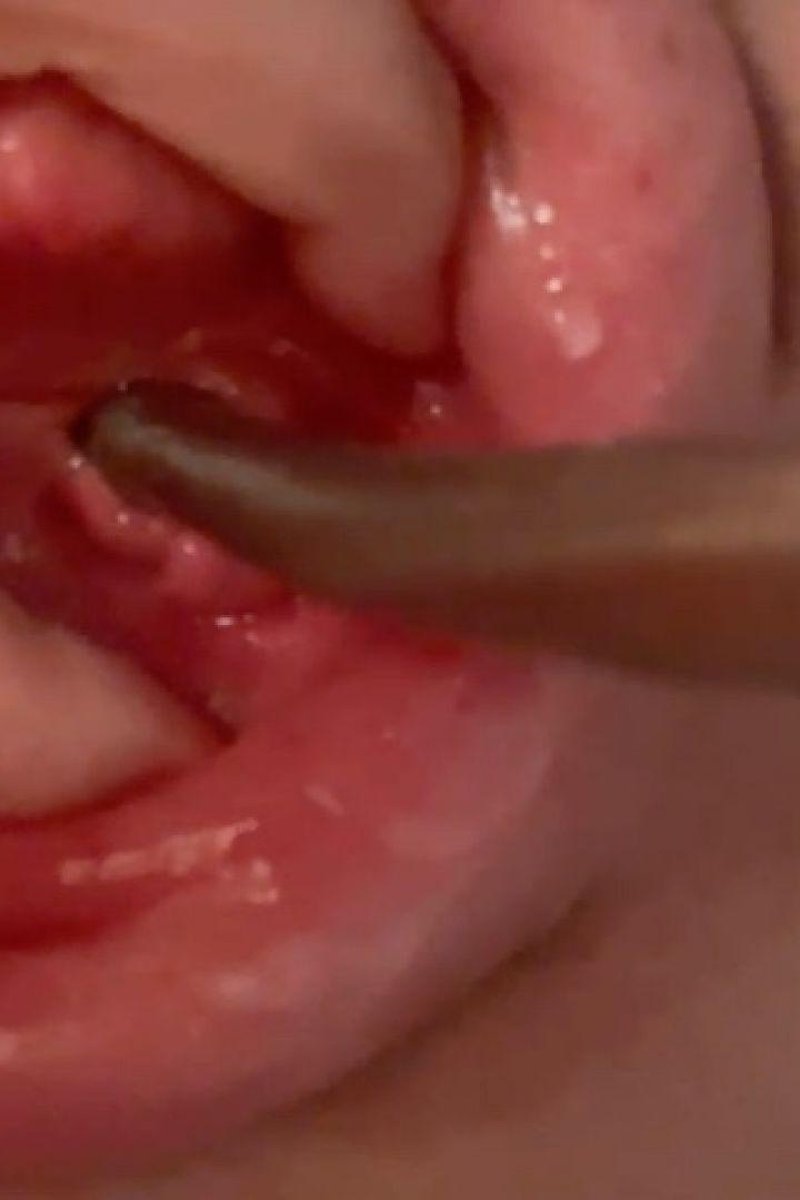 Peehole Sounding - Screenshot 1 of 4 - BDSM