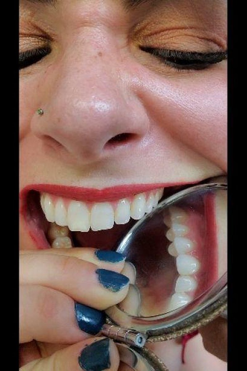 Littlest Bean's Teeth - Screenshot 1 of 4 - Close Up