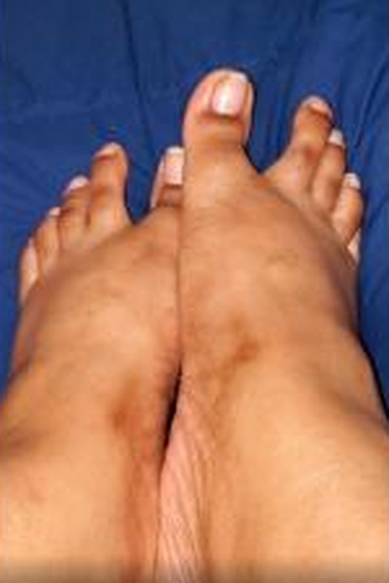 Toe Wiggling - Screenshot 1 of 4 - BBW